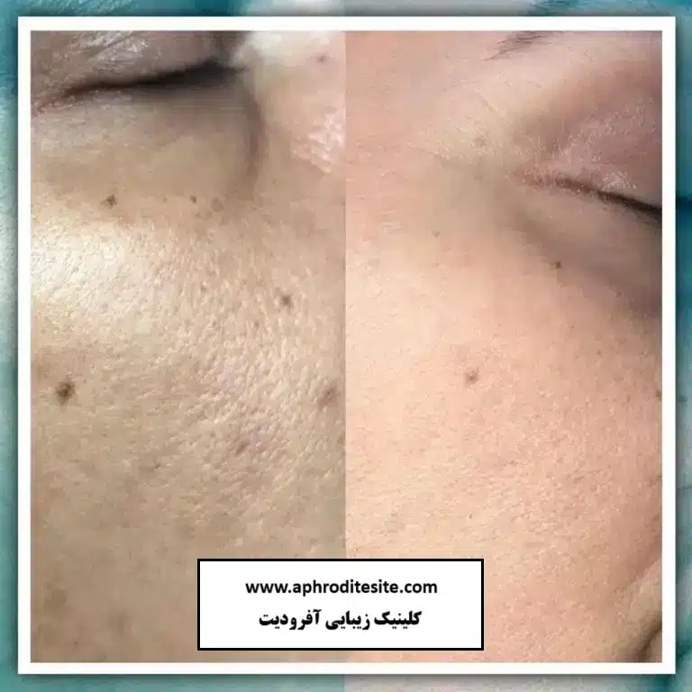 کرم پودر دایم