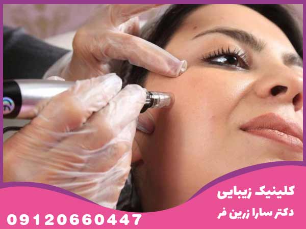آموزش میکرونیدلینگ